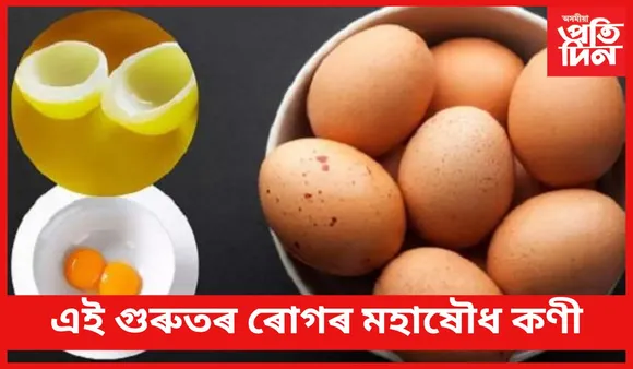 আপুনিও যদি এই ৰোগত আক্ৰান্ত, তেন্তে প্ৰতিদিনে কণী খাব